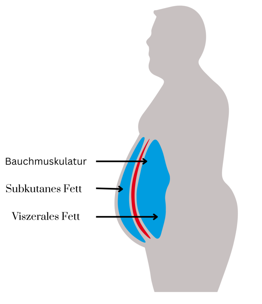 Baufett,Gefahr,Mann,Grafik,viszerales Fett,Bauchmuskulatur,Diabetes,Adipositas, dick,dicker Bauch